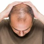 Haartransplantation und Sie