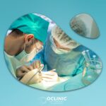 Saç Ekimi Merkezi Seçiminde Nelere Dikkat Edilmelidir?