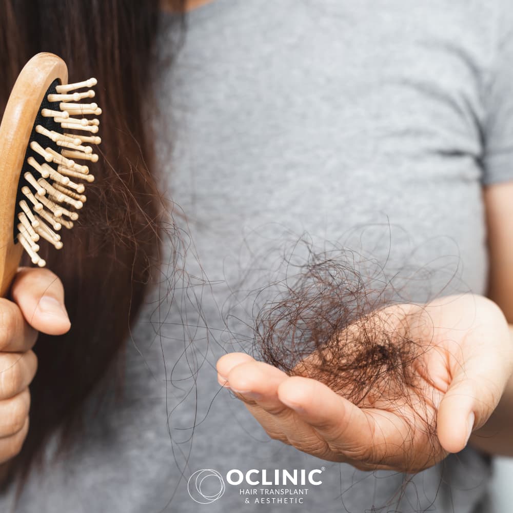 Kadınlarda Saç Dökülmesi